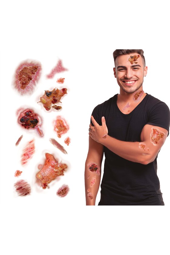 TATTOOS WITH INFECTED WOUNDS 30X13 CM
