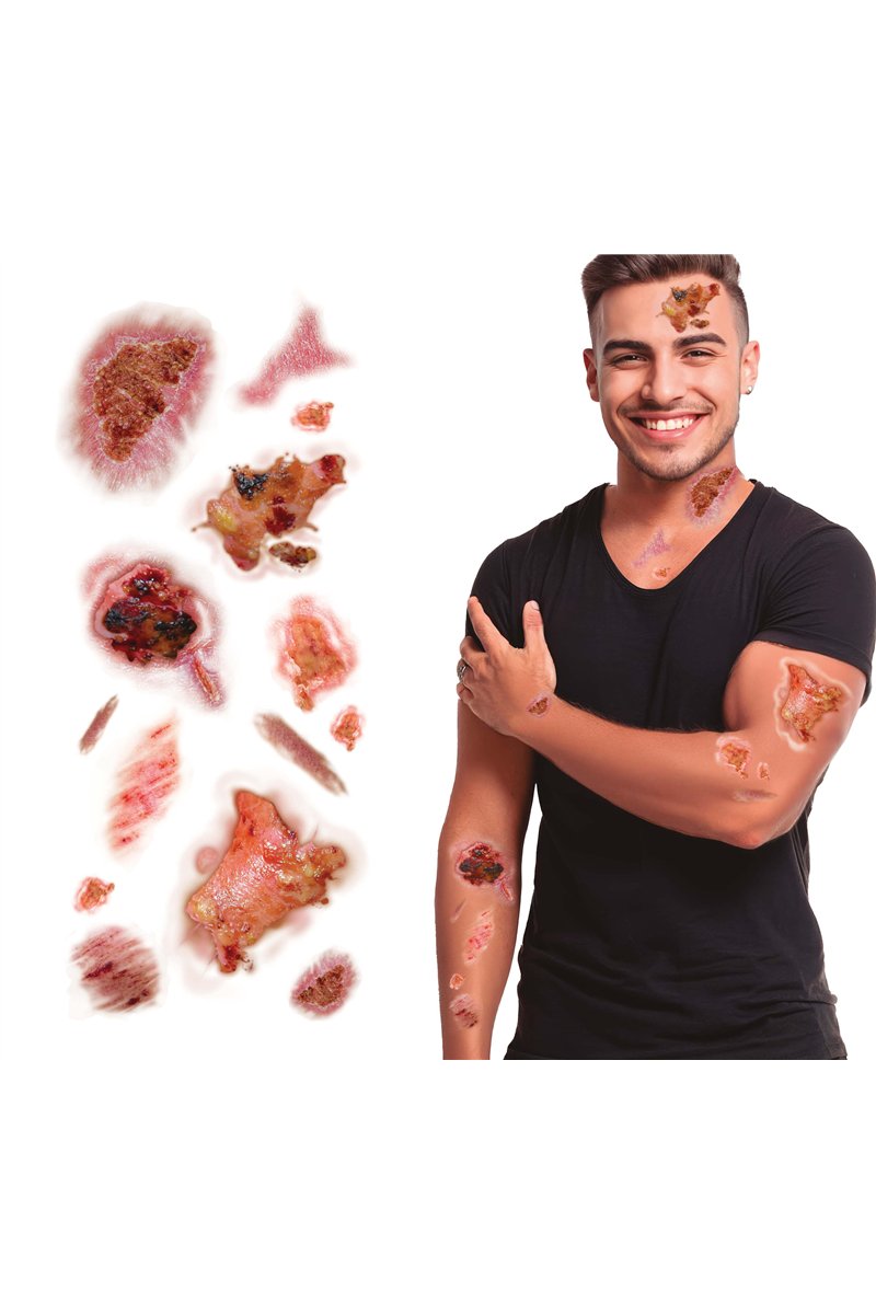 TATTOOS WITH INFECTED WOUNDS 30X13 CM
