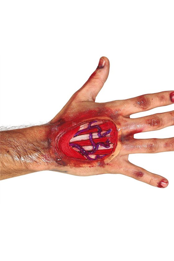 TENDON HAND SCAR 10 CMS, LATEX